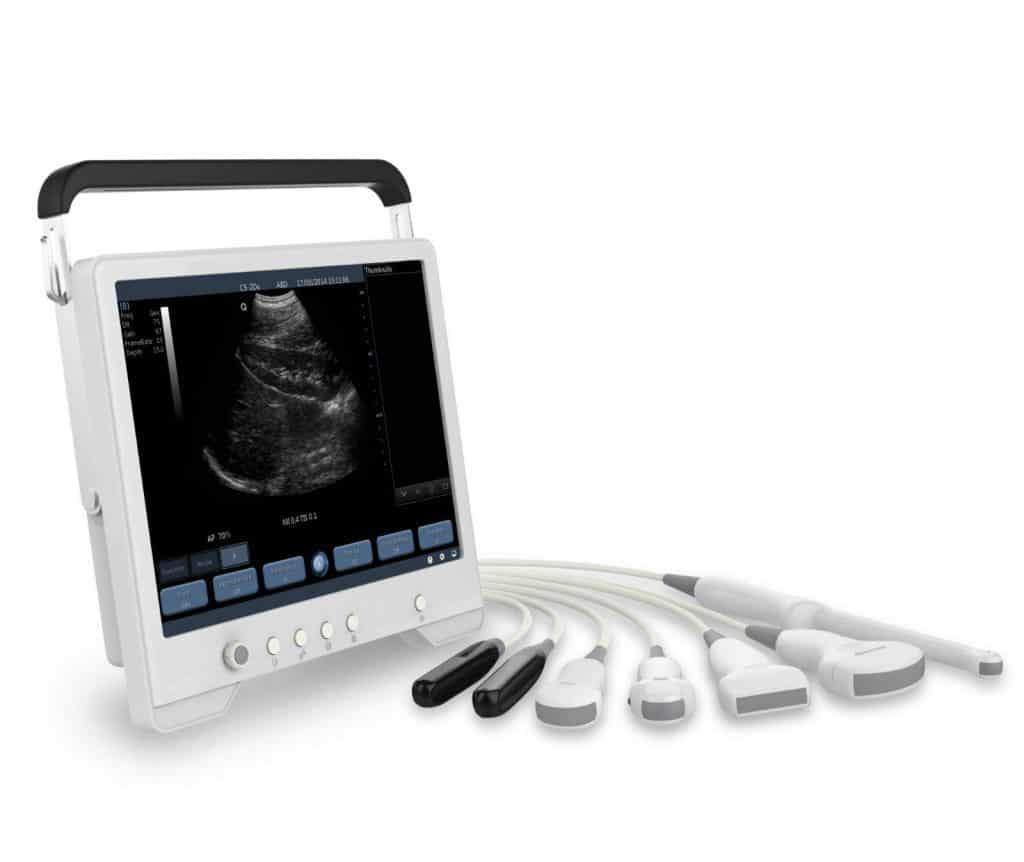 Scan Pad Portable Ultrasound Machines