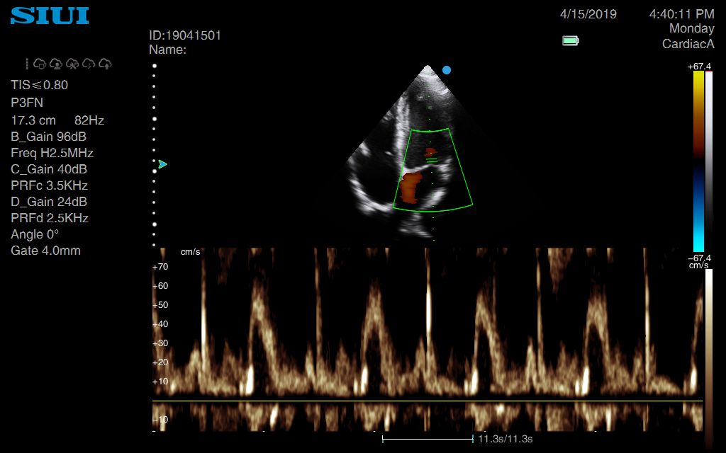 Echocardiography training