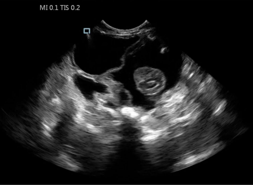 ScanX image